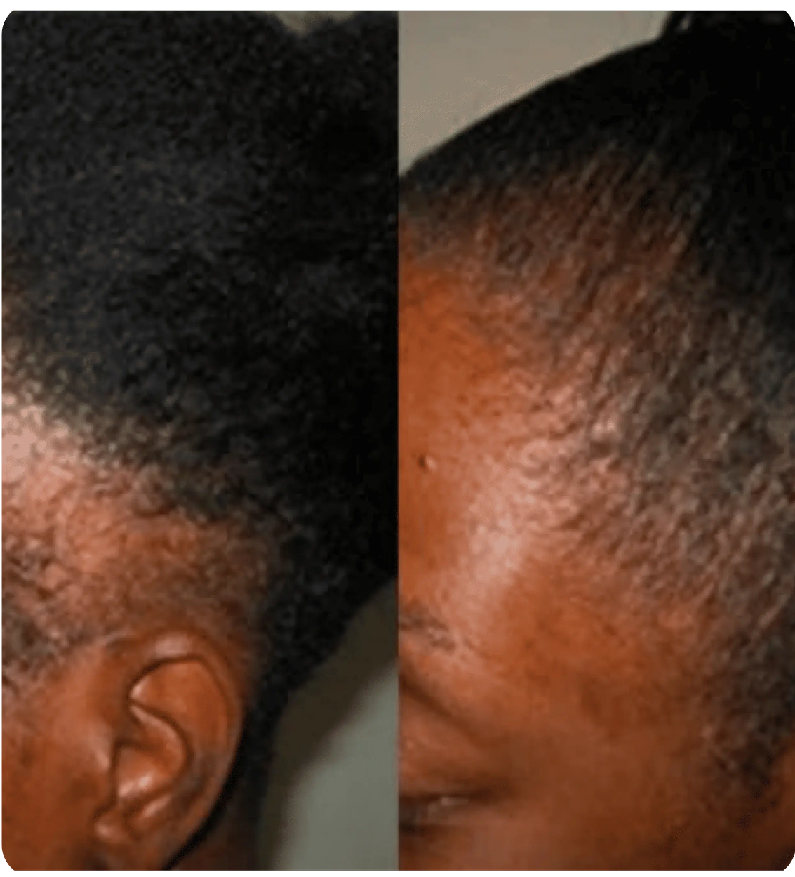 Huile Naturelle pour Cheveux Batana