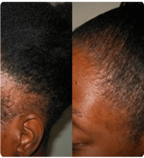 Huile Naturelle pour Cheveux Batana