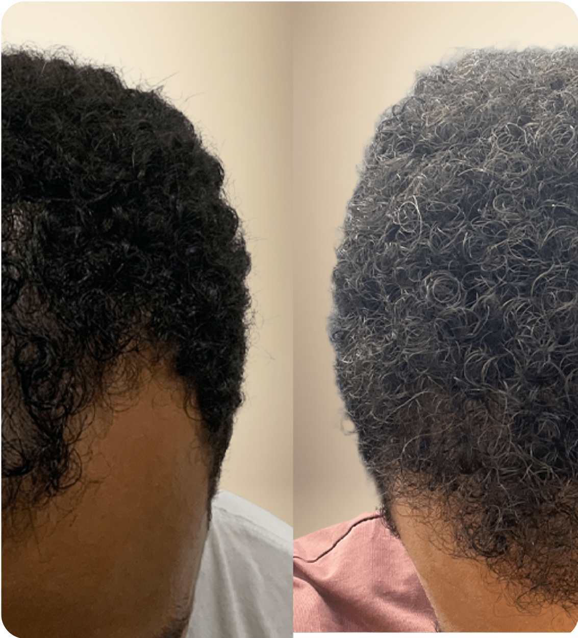 Huile Naturelle pour Cheveux Batana