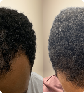 Huile Naturelle pour Cheveux Batana