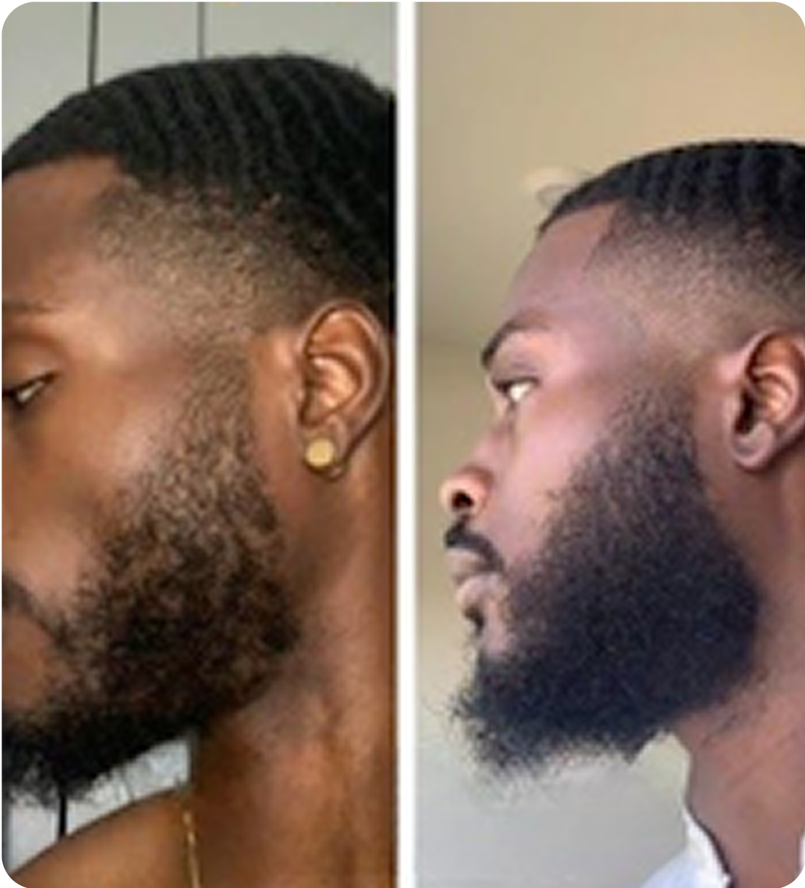 Huile Naturelle pour Cheveux Batana